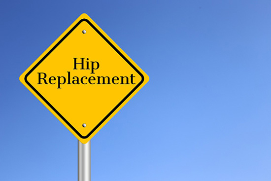 What Are Signs of Needing a Hip Replacement?