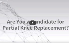 Are You a Candidate for Partial Knee Replacement?