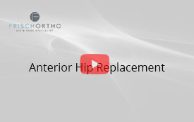 Femoroacetabular Impingement