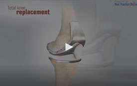 Minimally Invasive Knee Joint Replacement